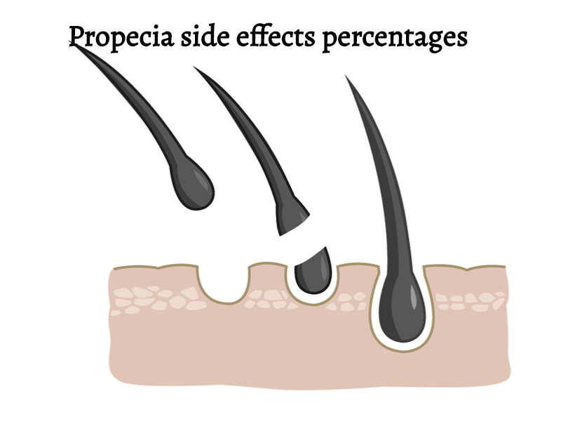 Propecia side effects percentages