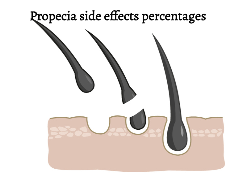 propecia side effects memory loss