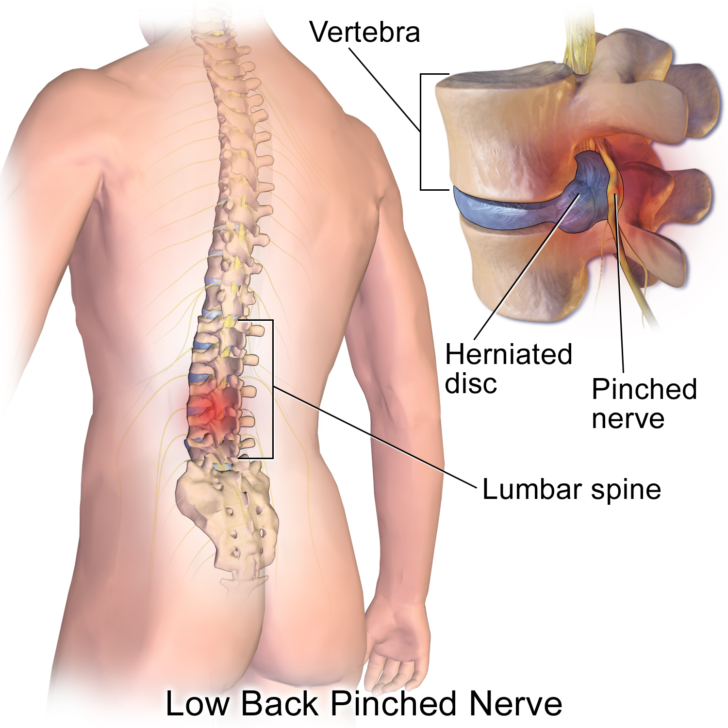 causes of lower back pain