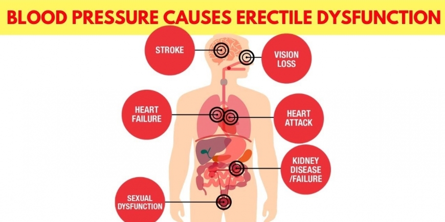 High Blood Pressure causes Erectile Dysfunction