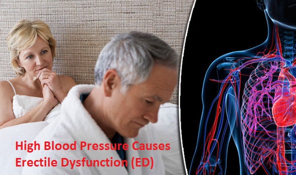 High Blood Pressure Causes Erectile Dysfunction