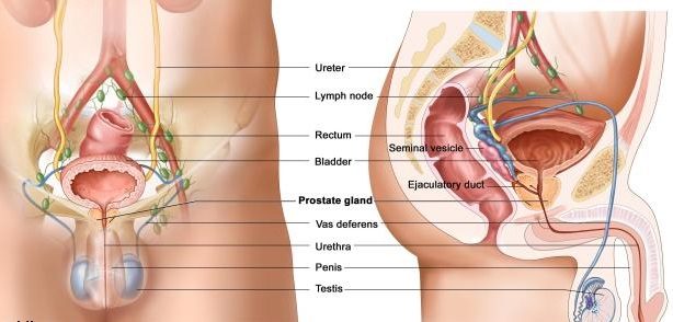 What is Prostate Cancer?