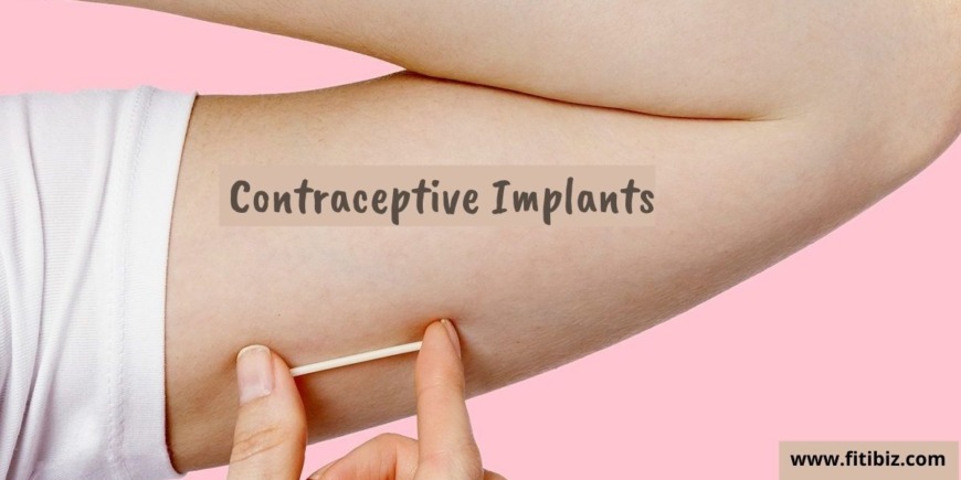 Contraceptive Implant: The Long Term Birth Control Method